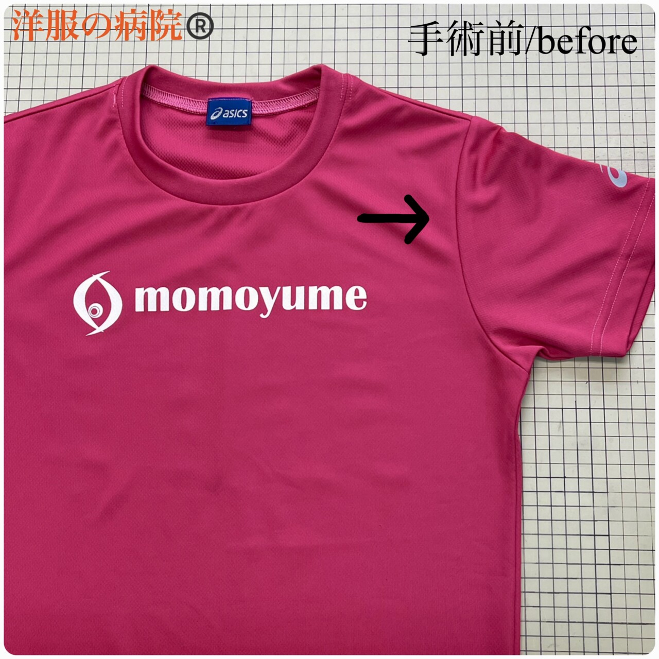 Tシャツの袖を取るお直し