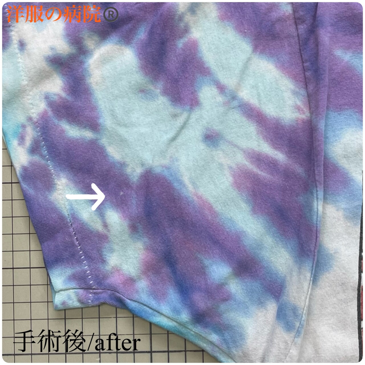 Tシャツの穴を塞ぐお直し