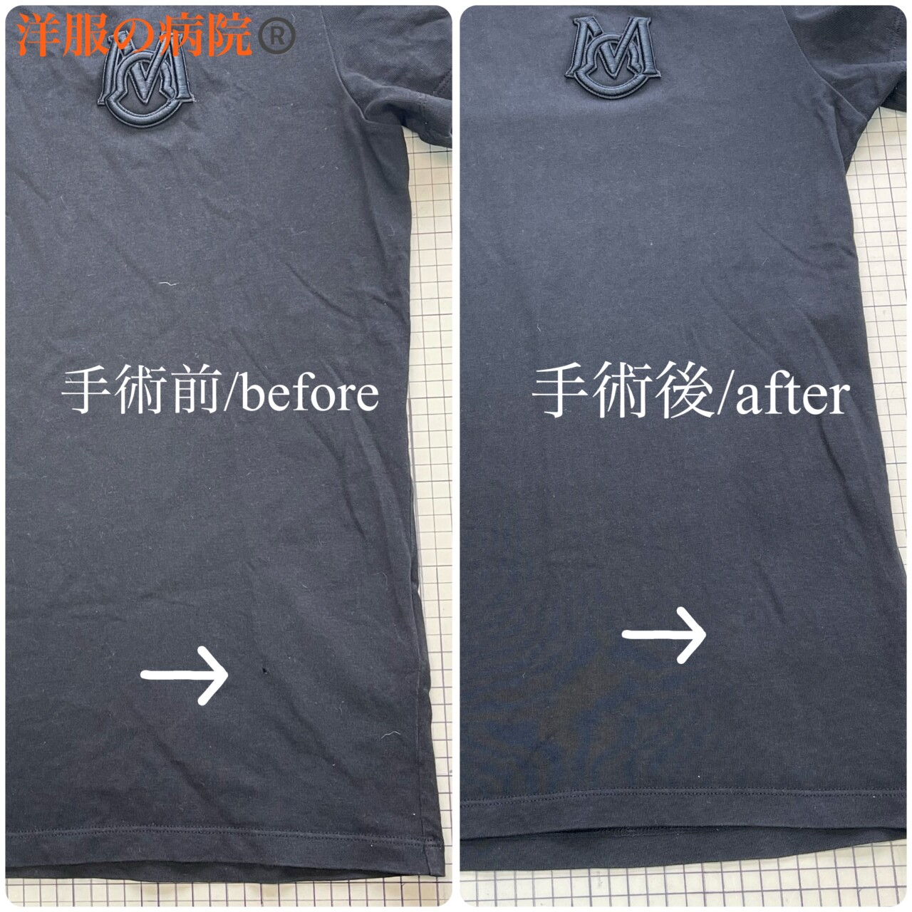 Ｔシャツの穴開きを塞ぐお直し（かけつぎ）