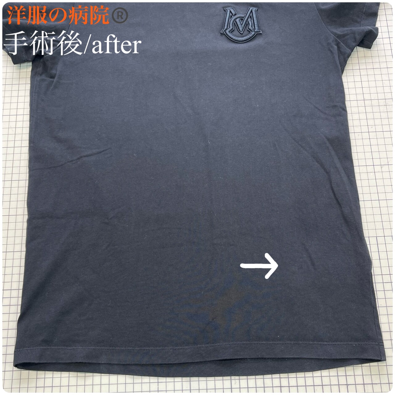 Ｔシャツの穴開きを塞ぐお直し（かけつぎ）