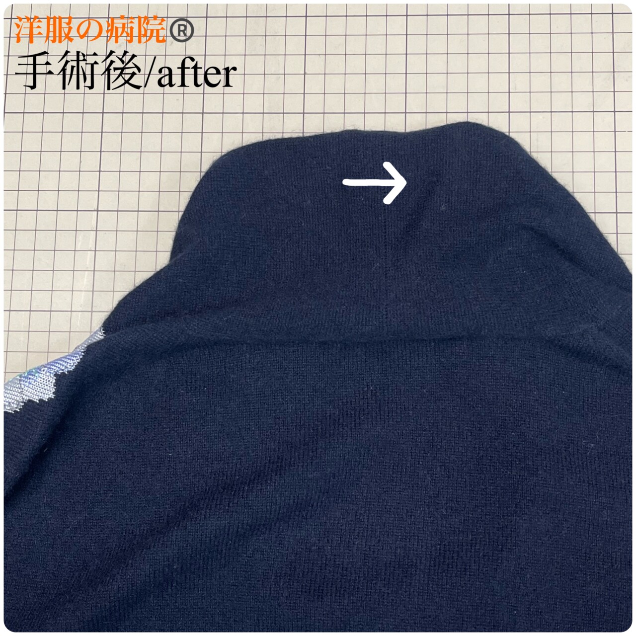 ニットにあいた穴のお直し（かけつぎ）