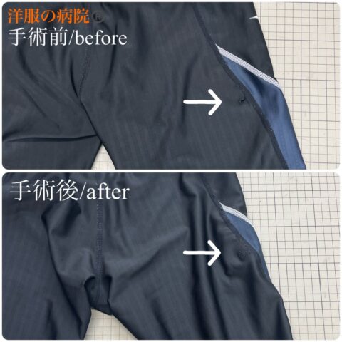 水着の破れた部分を縫いつぶすお直し