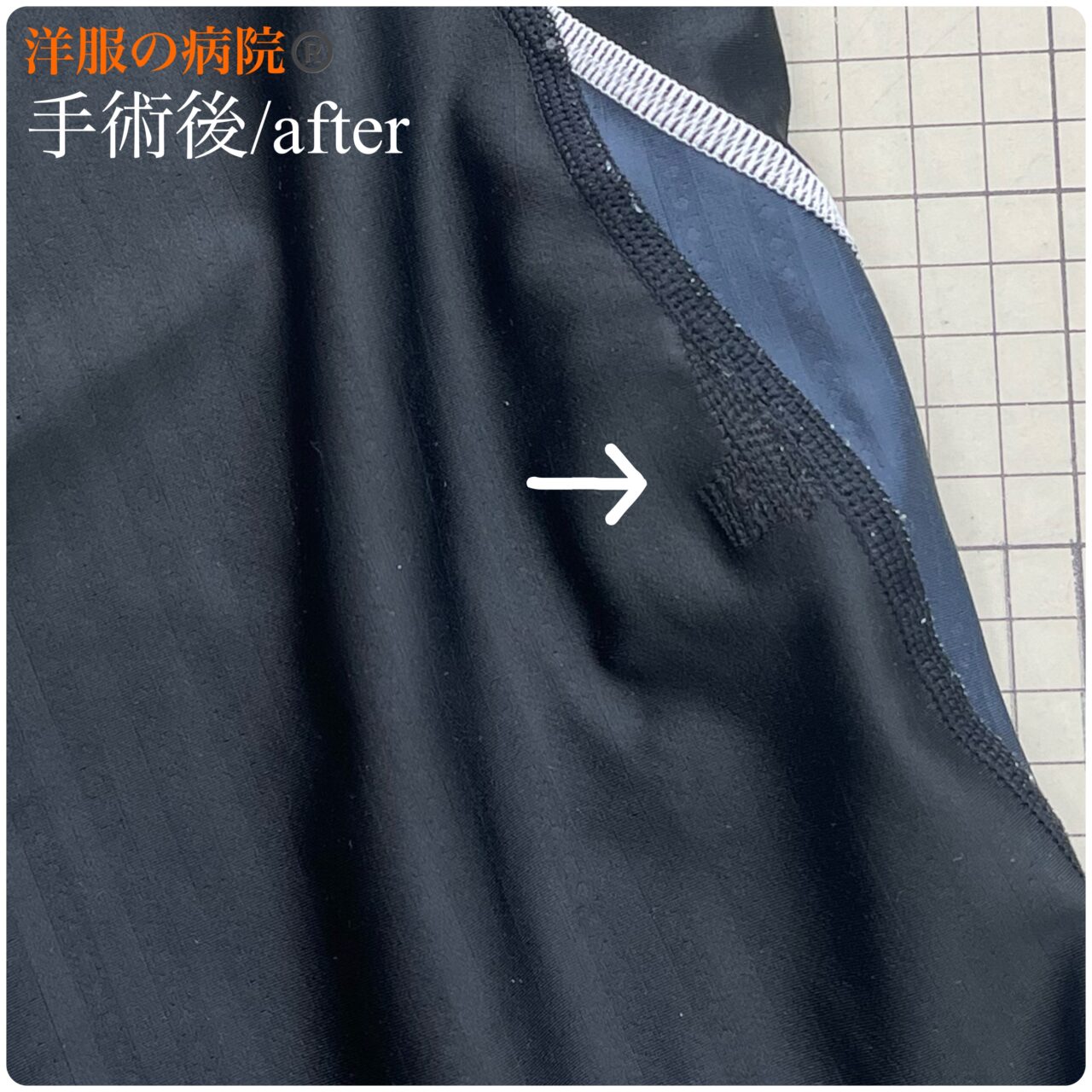 水着の破れた部分を縫いつぶすお直し