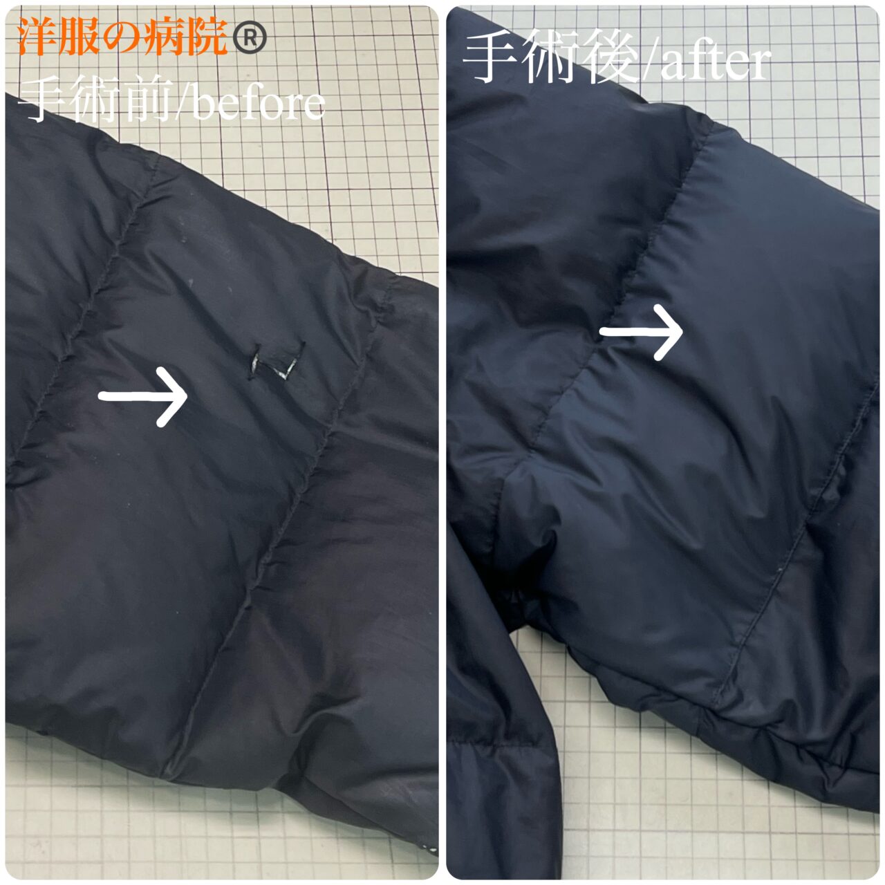 ダウンの袖が破れた部分のお直し