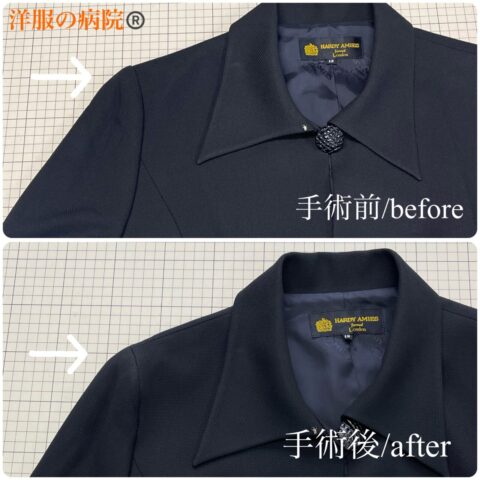 ジャケットの肩を滑らかにするお直し（アンコン加工）