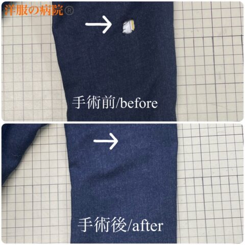 ジャケットに出来た穴を塞ぐお直し（かけつぎ）