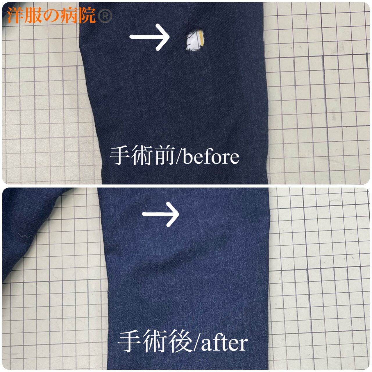 ジャケットに出来た穴を塞ぐお直し（かけつぎ）