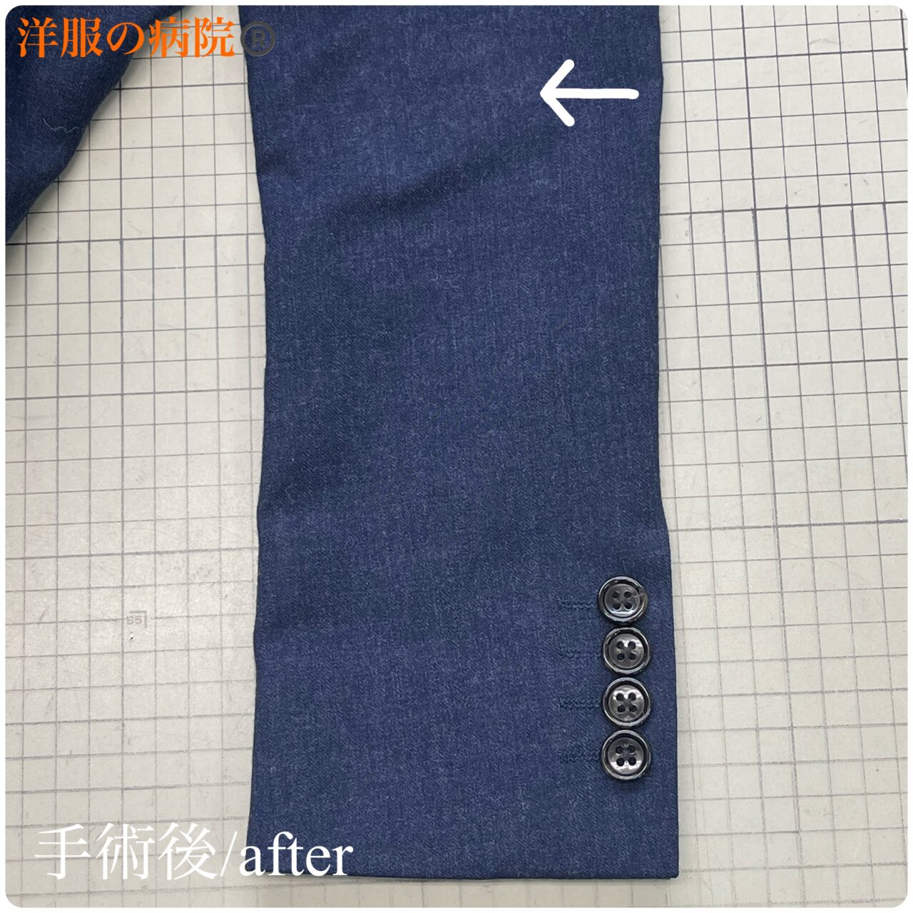 ジャケットに出来た穴を塞ぐお直し（かけつぎ）