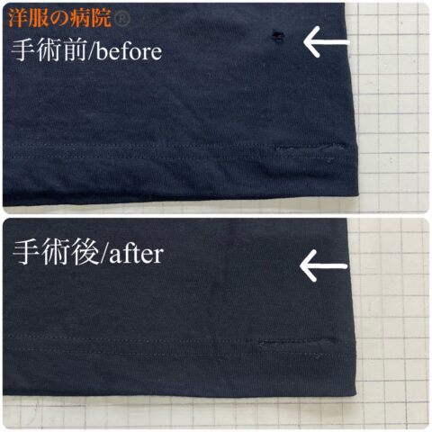 Tシャツに出来た穴をかけつぎで塞ぐお直し