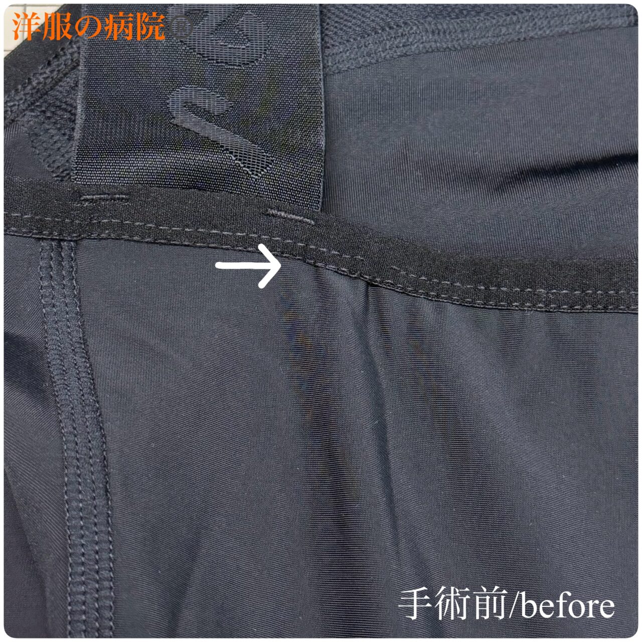 ビブショーツのほつれた部分を縫い直すお直し