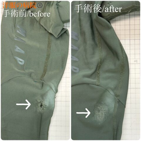 ビブショーツの膝が破れた部分を縫いつぶすお直し