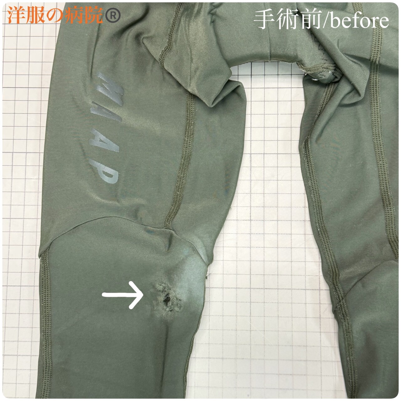 ビブショーツの膝が破れた部分を縫いつぶすお直し