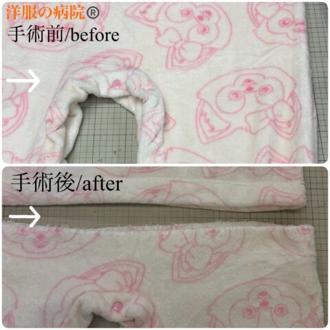 ロンパースからワンピースにするお直し