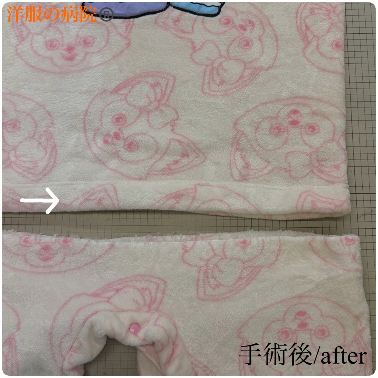 ロンパースからワンピースにするお直し