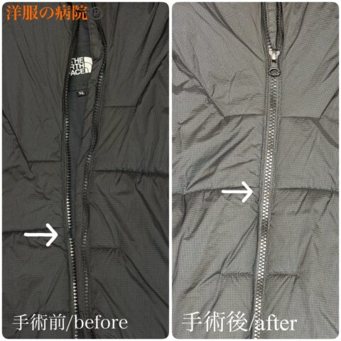 アウターのファスナー部分のエレメントを付け直すお直し