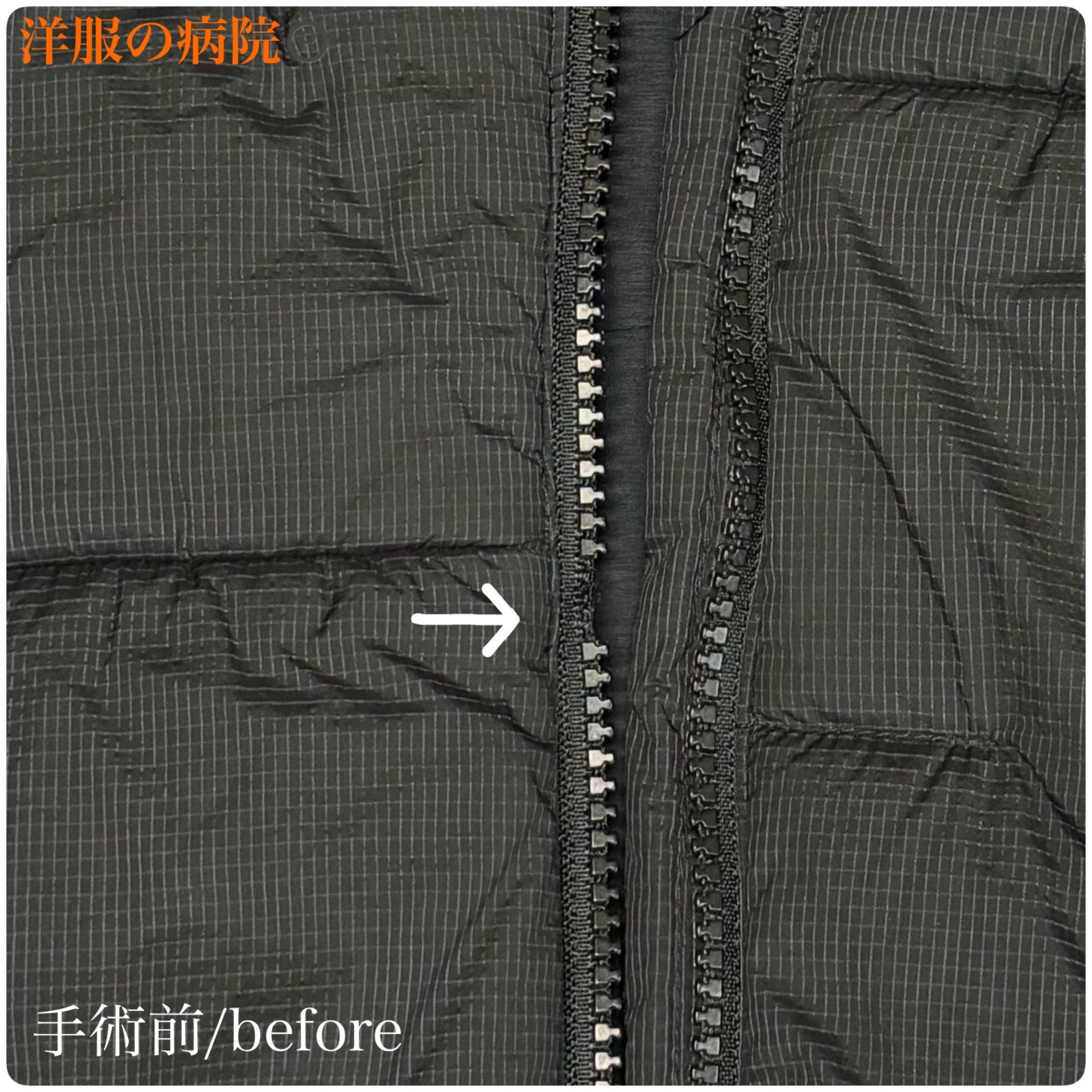 アウターのファスナー部分のエレメントを付け直すお直し