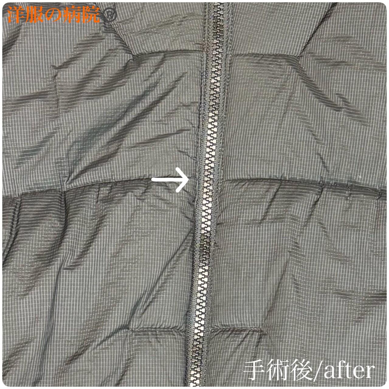 アウターのファスナー部分のエレメントを付け直すお直し