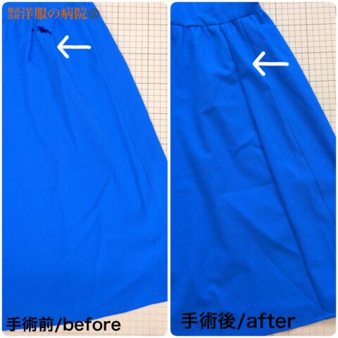 ワンピースの破れた部分を幅を細くする形で縫いこむお直し