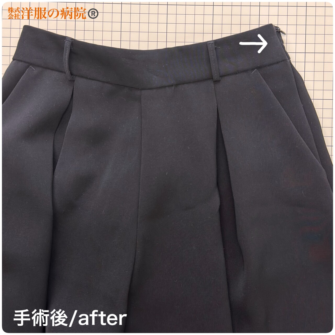 パンツにファスナーを取り付けるお直し