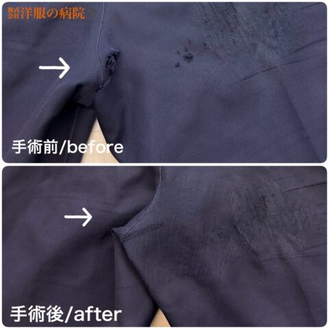 パンツの内股部分の破れを縫いつぶすお直し