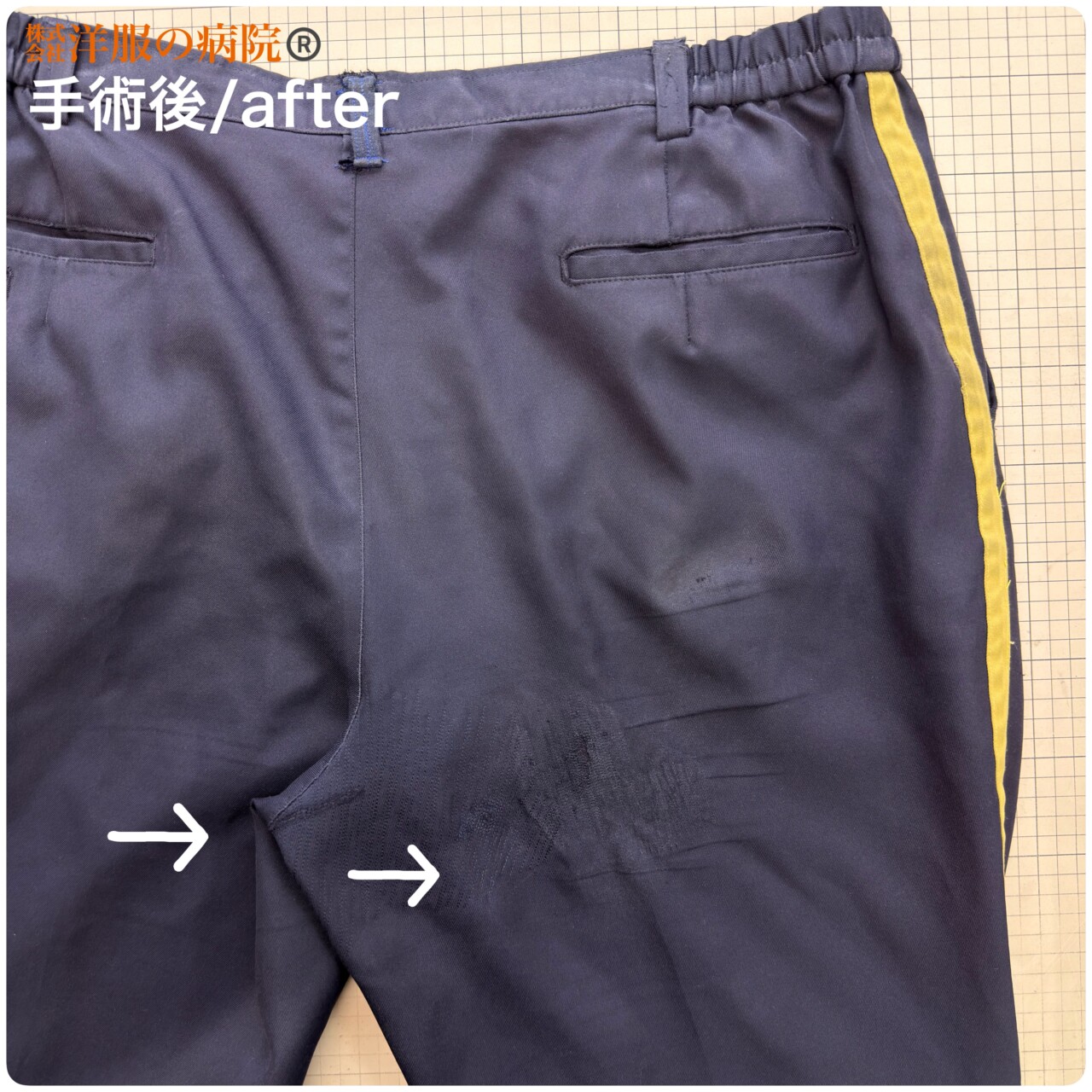 パンツの内股部分の破れを縫いつぶすお直し