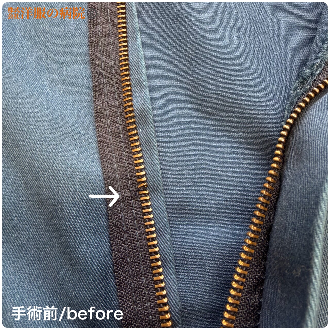 ファスナーのエレメントを調整するお直し