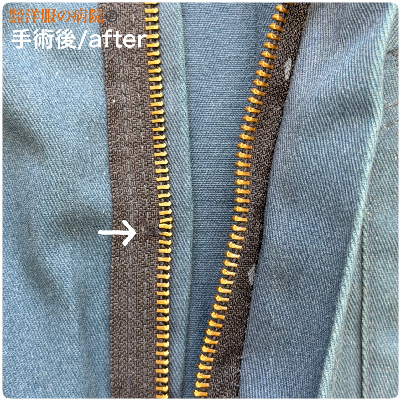 ファスナーのエレメントを調整するお直し